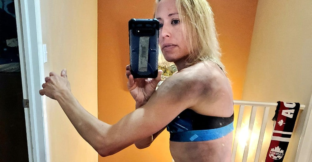 Saskatoon runner shares tips for sharing the trail after collision with mountain bikes