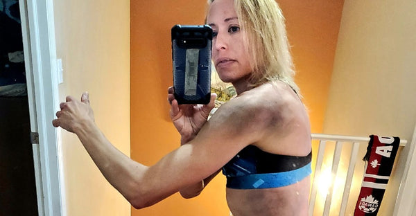 Saskatoon runner shares tips for sharing the trail after collision with mountain bikes